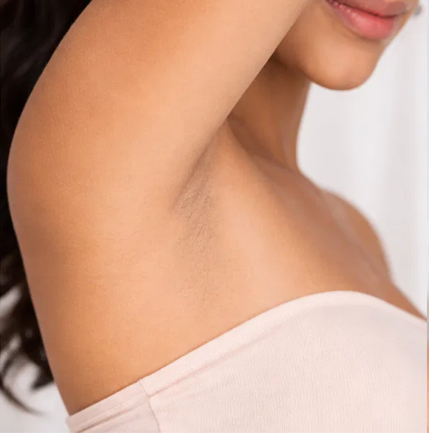 laser hair removal kochi after