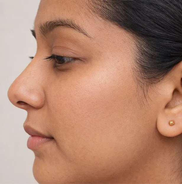 rash treatment kochi after