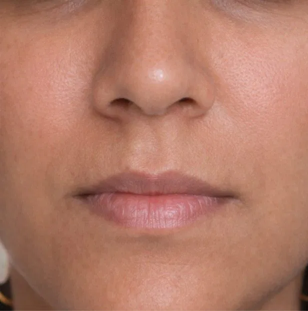 skin allergy treatment kochi after