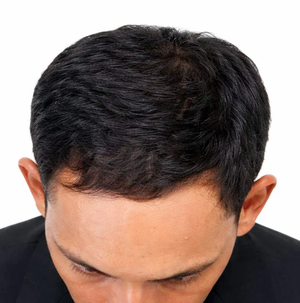 GFC after treatment kochi