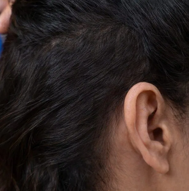 prp hair after results.jpg