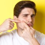 acne scars removal treatment