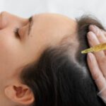 PRP GFC for Hair Loss