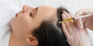PRP GFC for Hair Loss