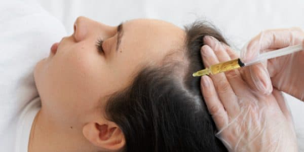 PRP GFC for Hair Loss